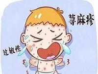厦门看荨麻疹较好的皮肤科医院