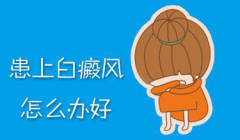 白癜风如何治疗