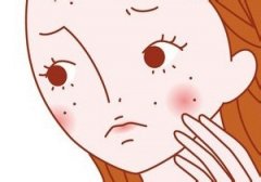 痤疮是怎么引起的