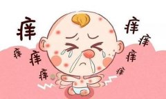 湿疹是由什么引起的