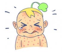 荨麻疹是什么引起的