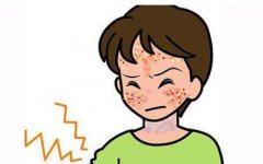 患了皮炎怎么办