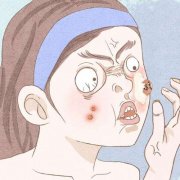 痤疮为什么会形成呢