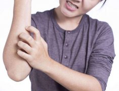 荨麻疹患者日常生活中需要注意什么