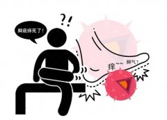 厦门怎么治疗脚气比较好